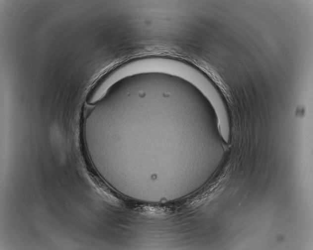 X0000099380442200806051125