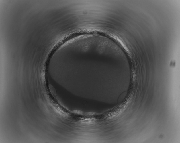 X0000099380447200806051125