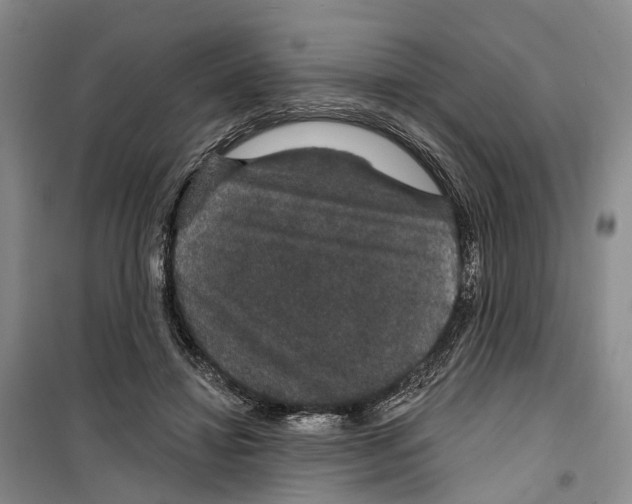 X0000099380452200806051125