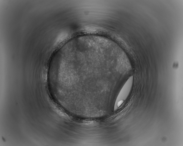 X0000099380454200806051125