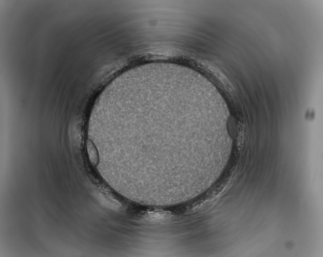 X0000099380455200806051125