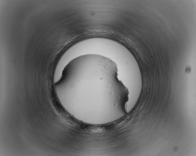 X0000099380456200806051125