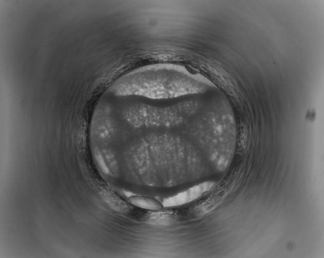 X0000099380461200806051125