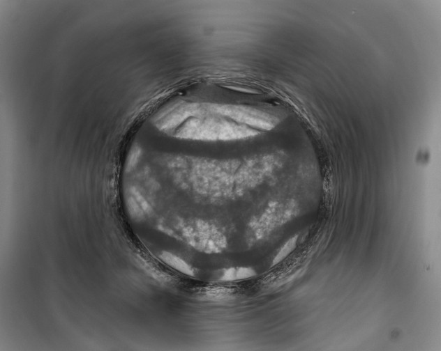 X0000099380462200806051125