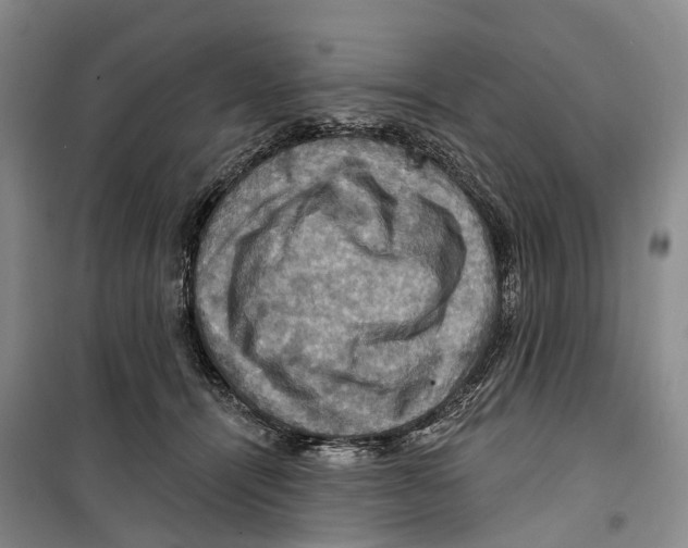 X0000099380464200806051125