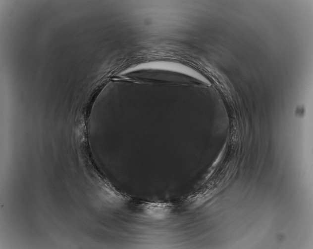 X0000099380465200806051125