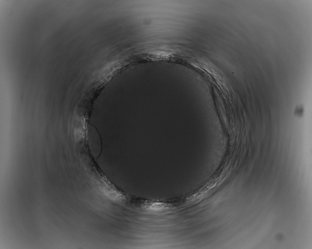 X0000099380467200806051125