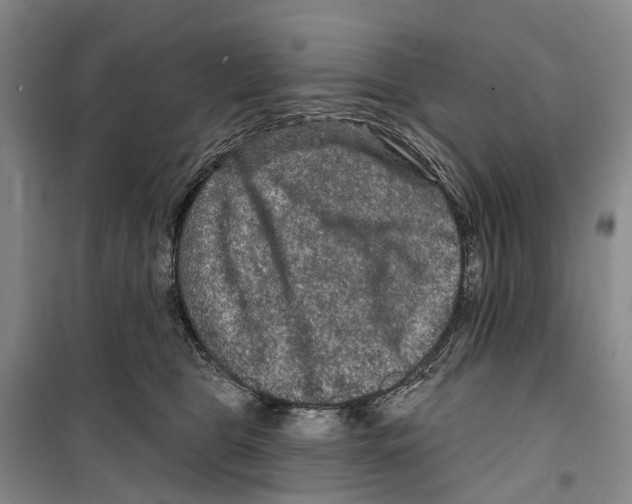 X0000099380469200806051125