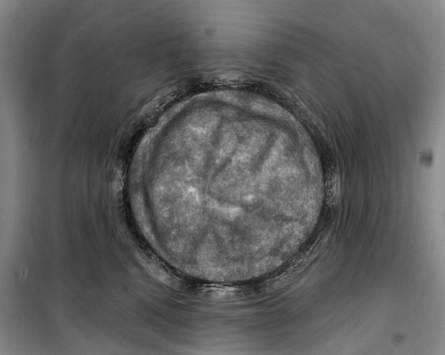 X0000099380472200806051125