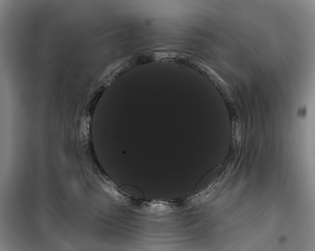 X0000099380475200806051125