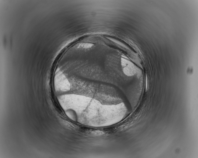 X0000099380483200806051124