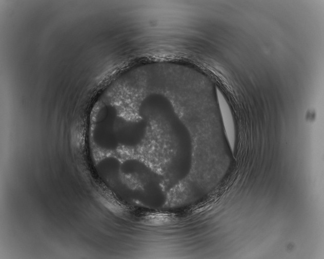 X0000099380499200806051124