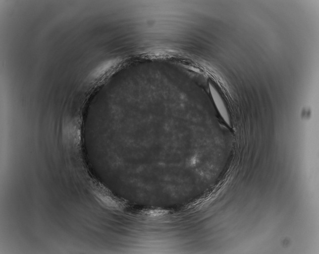 X0000099380501200806051124