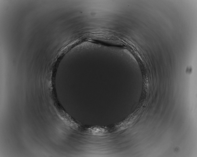 X0000099380512200806051124