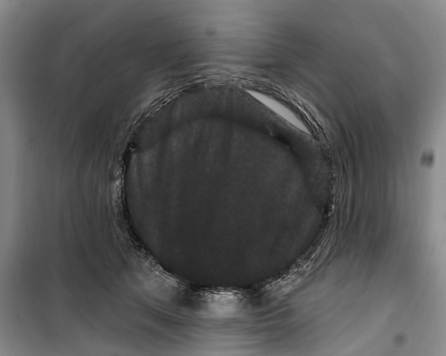 X0000099380513200806051124