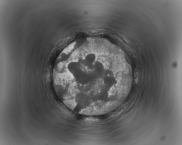 X0000099380515200806051124