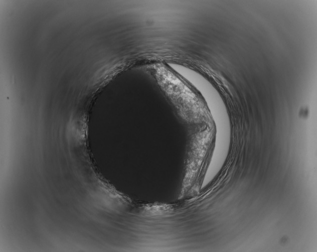 X0000099380517200806051124