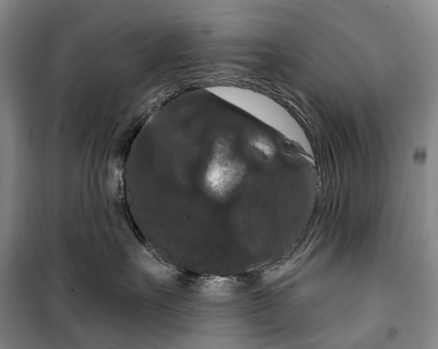 X0000099380527200806051124