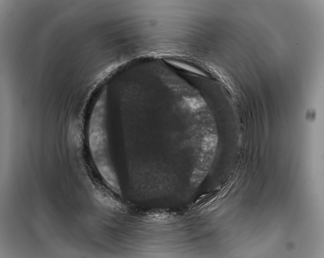 X0000099380540200806051123