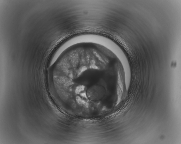 X0000099380542200806051123