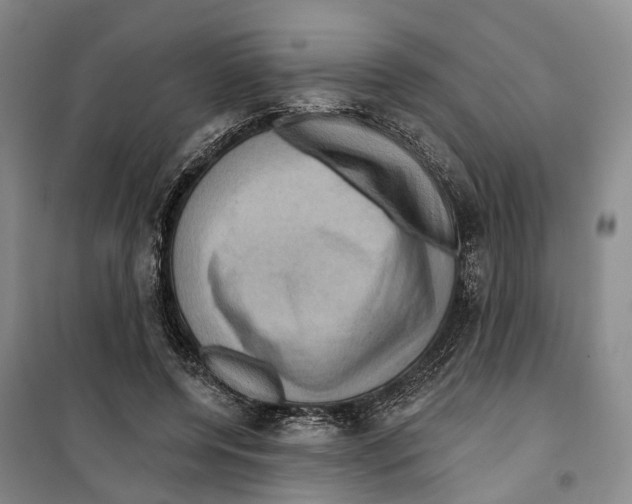 X0000099380544200806051123