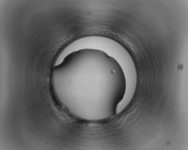X0000099380546200806051123