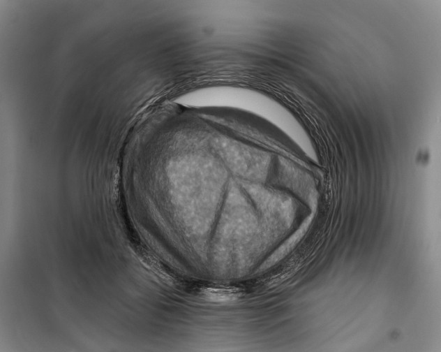 X0000099380556200806051123