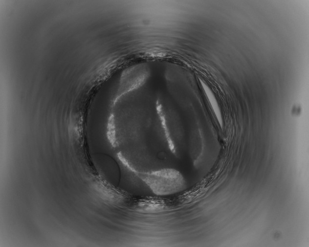 X0000099380559200806051123