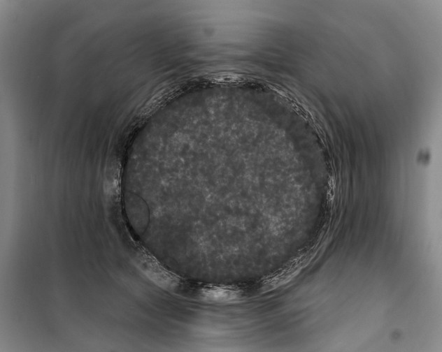 X0000099380561200806051123