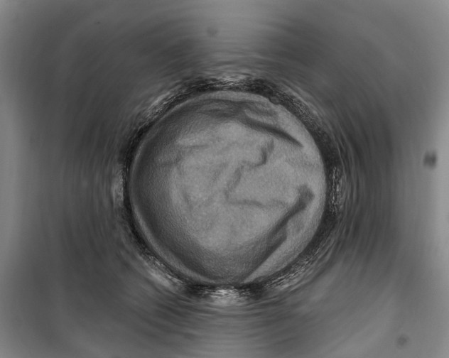 X0000099380562200806051123