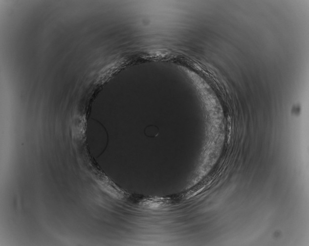 X0000099380563200806051123