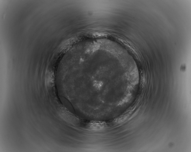 X0000099380571200806051123