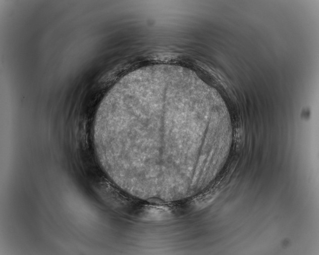 X0000099380572200806051123