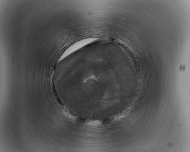 X0000099380576200806051124