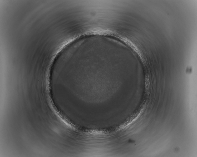 X0000099380581200806051123