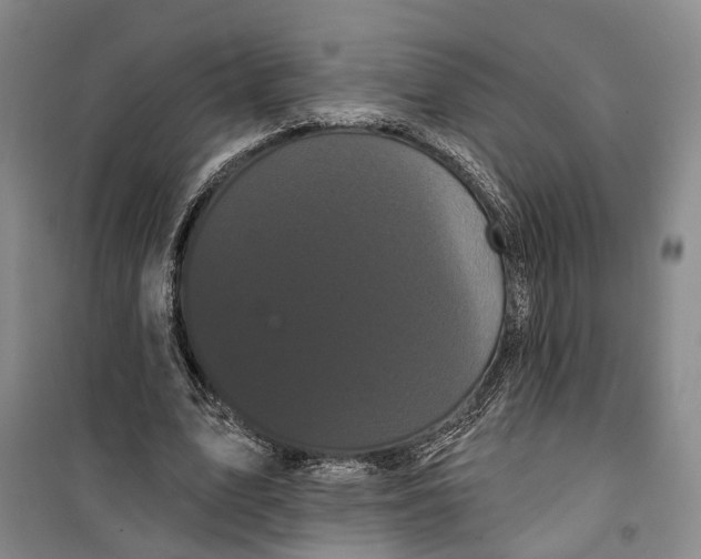 X0000099380583200806051123