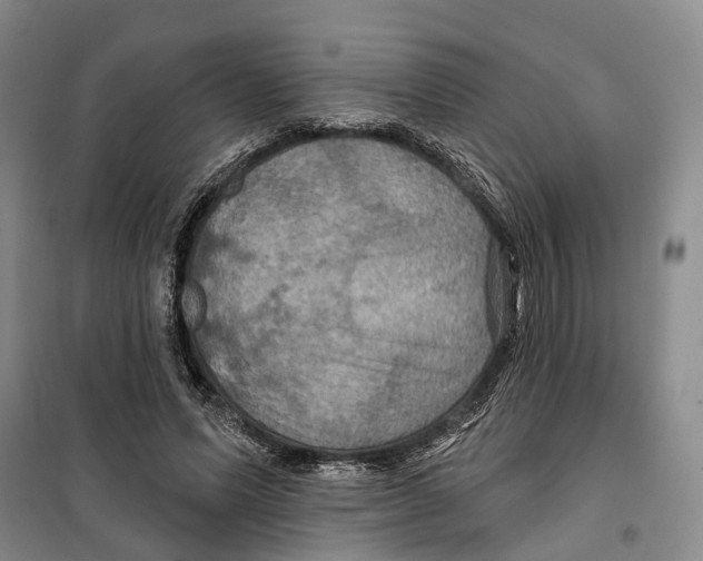 X0000099380591200806051123