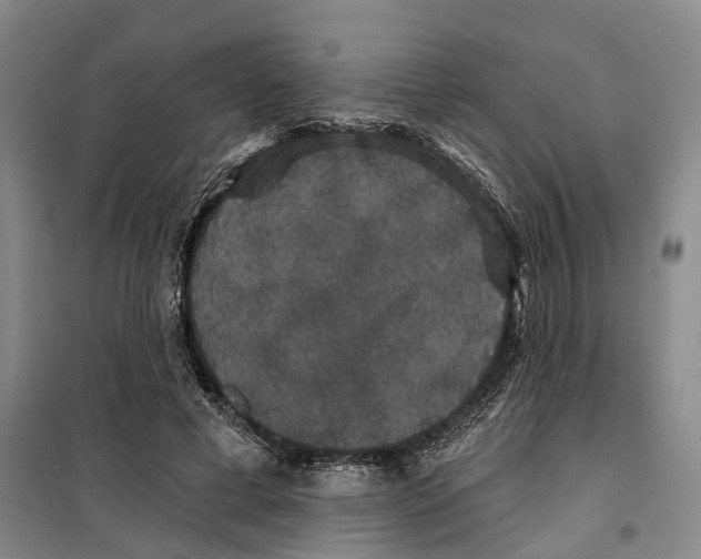 X0000099380593200806051123