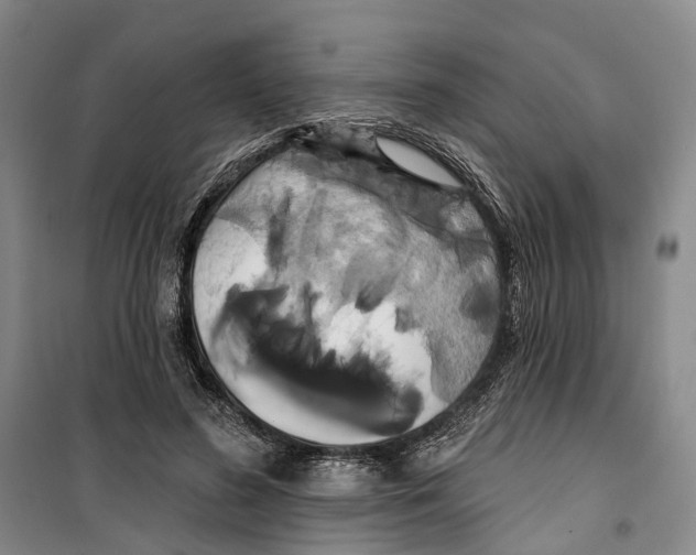 X0000099380596200806051123
