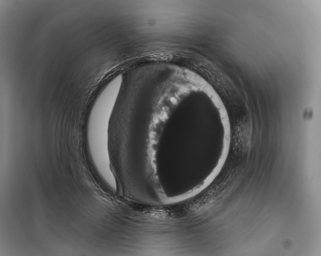 X0000099380600200806051122