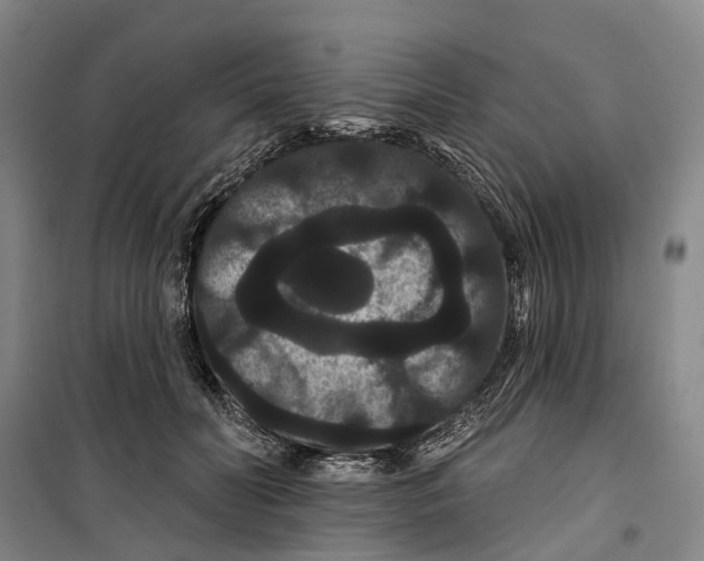 X0000099380606200806051122