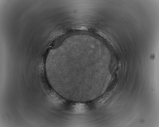 X0000099380609200806051122