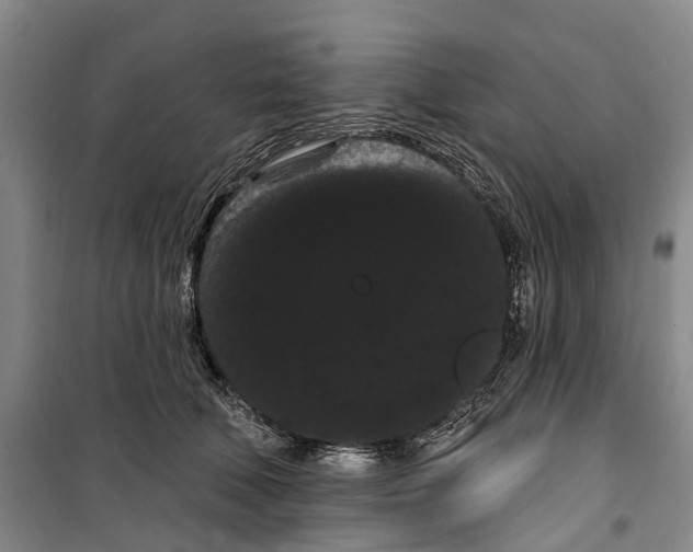 X0000099380610200806051122