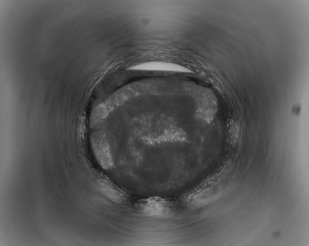 X0000099380612200806051122