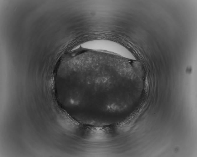 X0000099380613200806051122