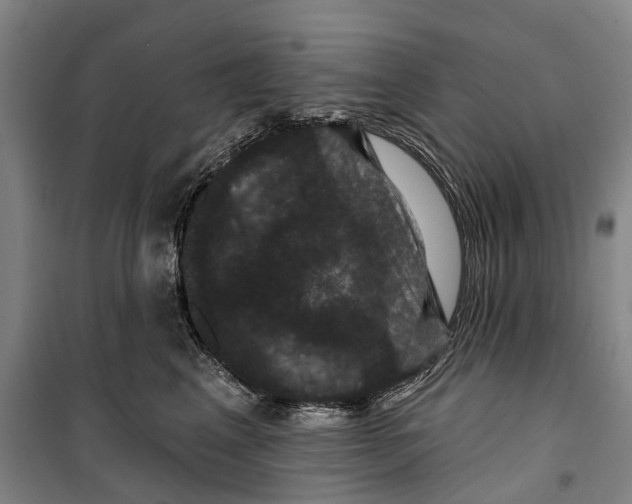 X0000099380617200806051122