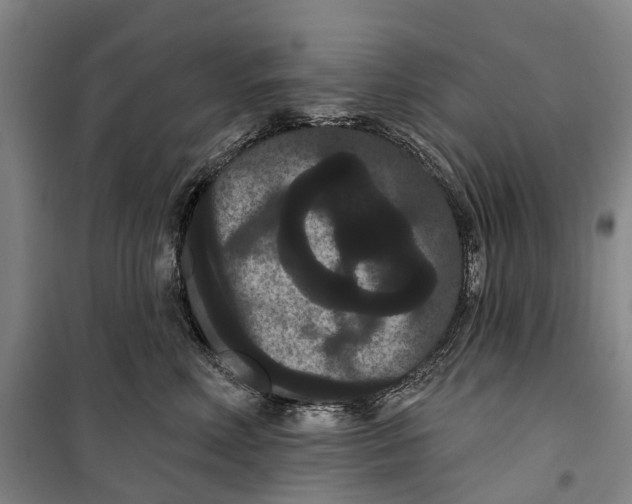 X0000099380618200806051122