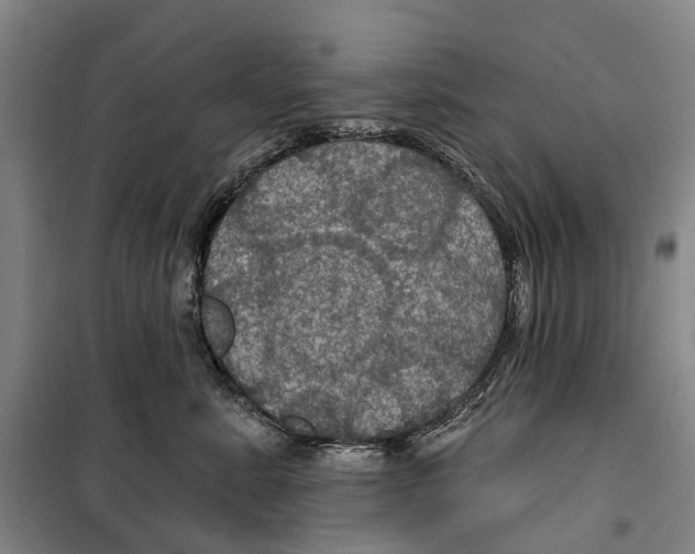 X0000099380619200806051122