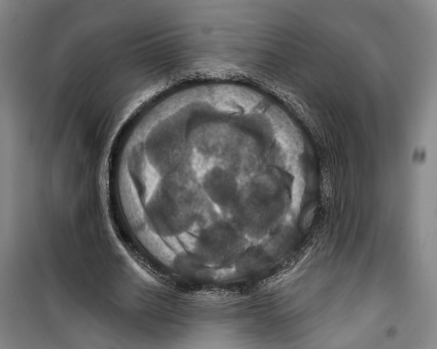 X0000099380630200806051121