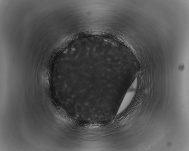 X0000099380643200806051122
